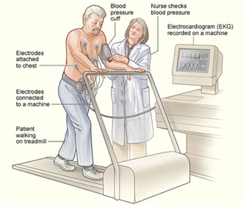 blood pressure drop during treadmill stress test|blood pressure during exercise testing.